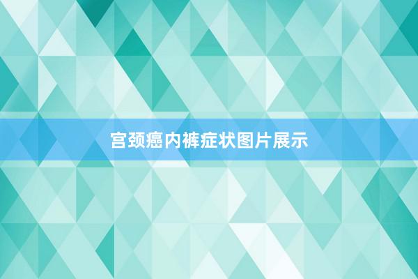 宫颈癌内裤症状图片展示