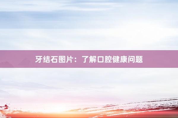 牙结石图片：了解口腔健康问题